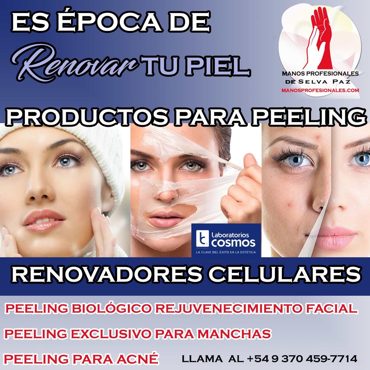 PRODUCTOS para REALIZAR PEELING LABORATORIOS COSMOS